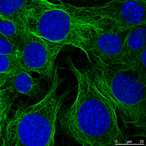 microtubuli_controle 3_z0